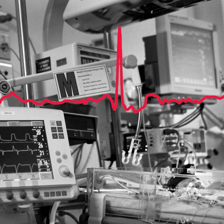 Photo composite of ECG readout over image from pediatric ICU at SickKids. (Courtesy Laussen Labs)